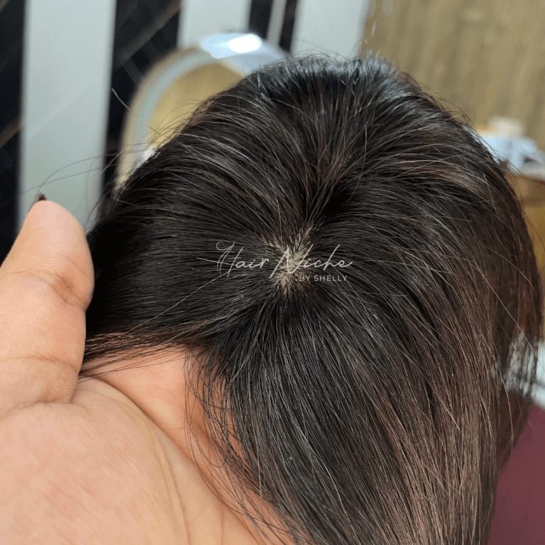 Scalp Line Topper